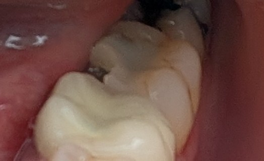 PXL_20260908_202334949~2